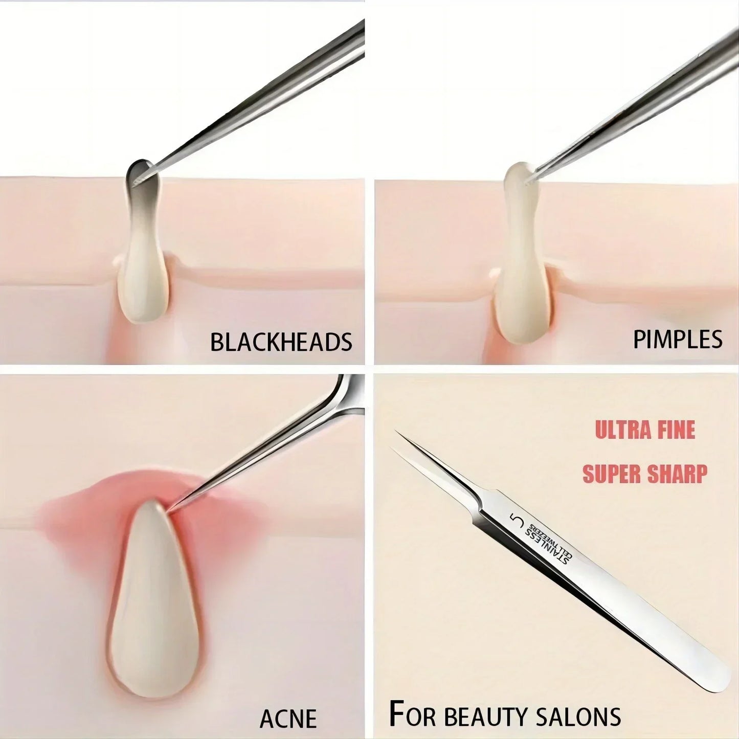 Acne Removal Tweezers